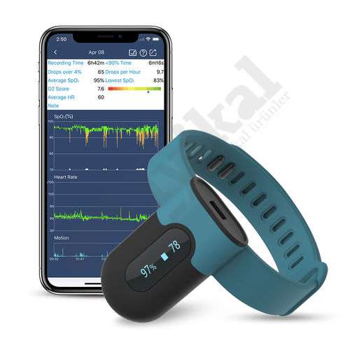 Viatom SleepU Pulse Oksimetre  / Uyku Apnesi Hastaları için PC Raporu ile Bluetooth İzleyici